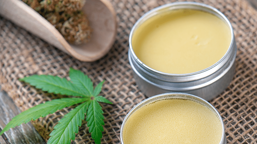 cbd cream